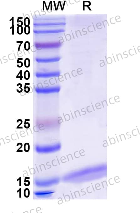 Anti-Human CD19 Nanobody (SAA2078)
