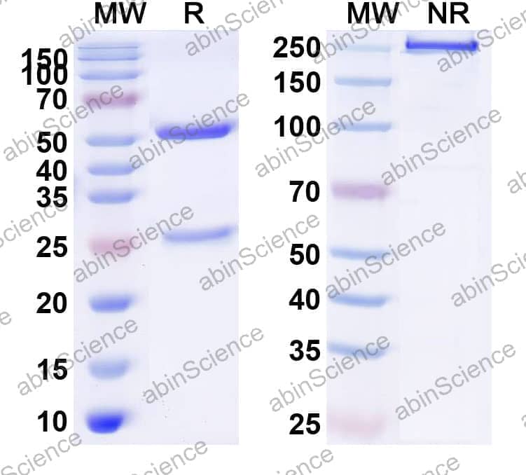Anti-Human CD19 Antibody (SJ25C1)