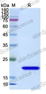 Recombinant Human BTK Protein, N-His