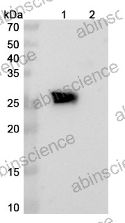 Research Grade Cinrebafusp alfa