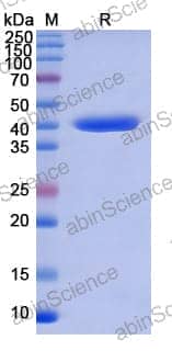 Recombinant Human TP53BP1 Protein, N-His