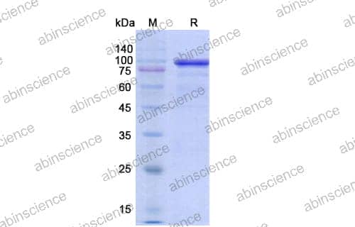 Recombinant Human TP53BP1 Protein, N-His-GFP