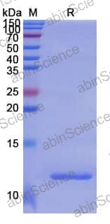 Recombinant Human CRHR2 Protein, N-His