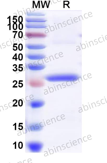 Recombinant Human CRHR2 Protein, N-His-SUMO
