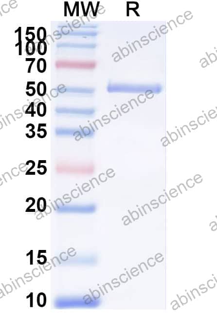 Recombinant Human GRIN1/NMDAR1 Protein, N-His-SUMO & C-strep