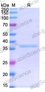 Recombinant Human MSLN Protein, N-His