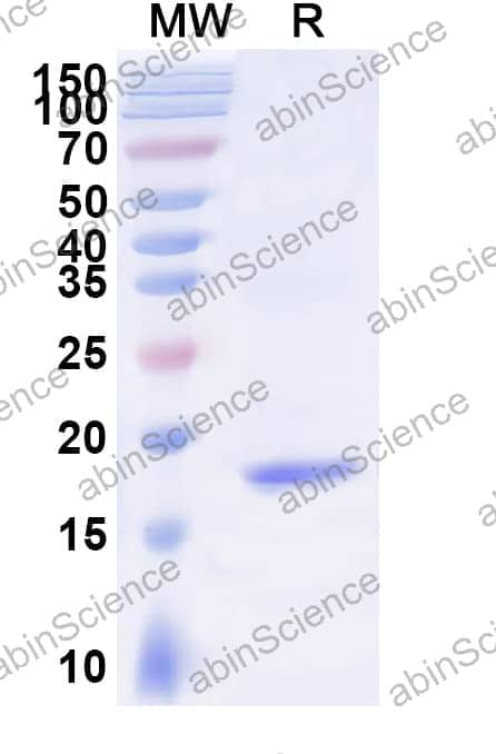 Anti-Human MSLN/Mesothelin Nanobody (SAA2050)