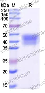 Recombinant Human MSLN/Mesothelin Protein, C-His