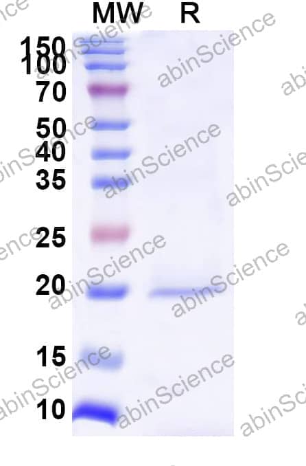 Anti-Human MSLN/Mesothelin Nanobody (YE-17)