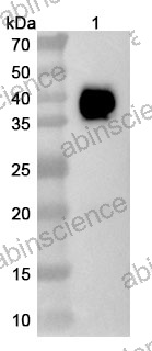 Anti-Human MSLN/Mesothelin Nanobody (YE-17)