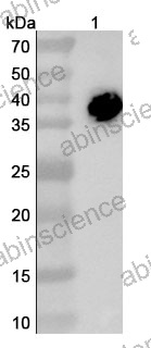 Research Grade Anti-CD3E & Mesothelin & Serum Albumin Trispecific Antibody (Hpn536)