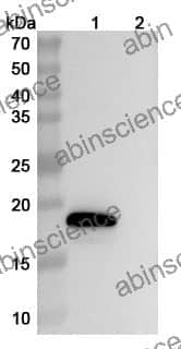 Recombinant Human IL18/IL1F4 Protein, C-His