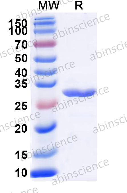 Recombinant Human IRF5 Protein, N-His