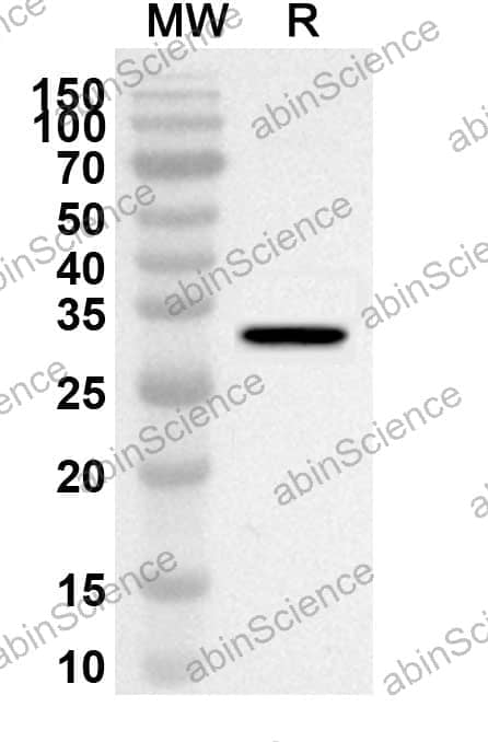Anti-IRF5 Polyclonal Antibody