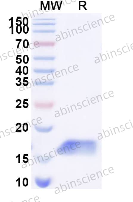 Anti-Human CDH17/Cadherin-17 Nanobody (SAA0804)