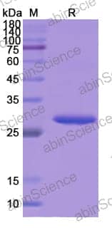 Recombinant Human STAT4 Protein, N-His