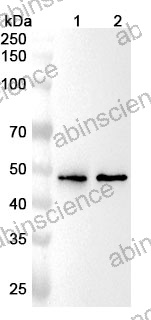 Anti-Human SLC18A2 Polyclonal Antibody