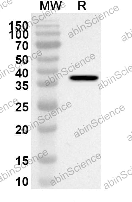 Anti-Human SLC18A2 Polyclonal Antibody