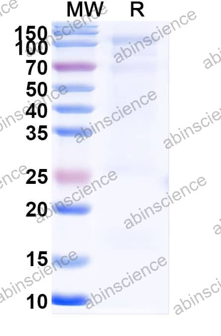 Recombinant Human FOLH1/PSMA Protein, C-His