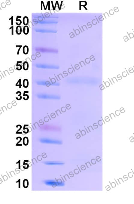 Recombinant Human EGFRvIII Protein, C-His