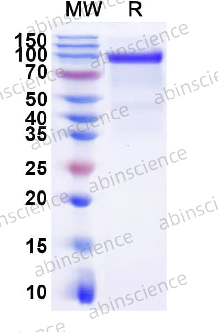 Recombinant Human EGFRvIII Protein, C-Fc