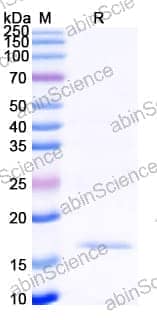 Recombinant Human EGFR/ERBB1/HER1 Protein, N-His