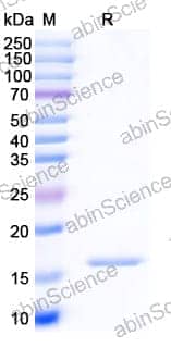 Recombinant Human EGFR/ERBB1/HER1 Protein, N-His