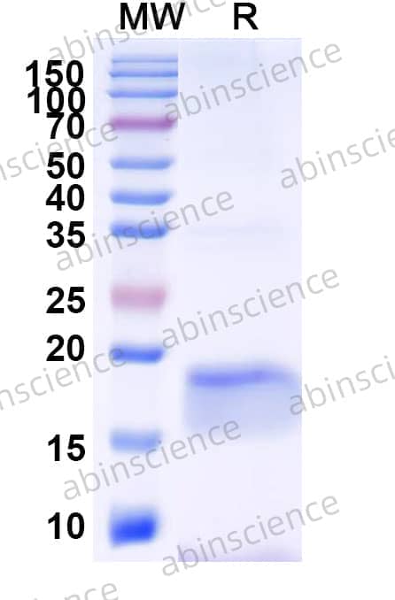 Anti-Human EGFR/ERBB1/HER1 Nanobody (9G8)