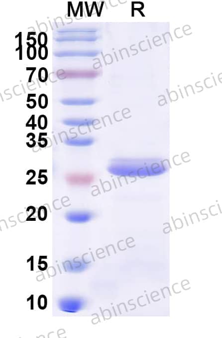 Recombinant Human TGM6 Protein, N-His