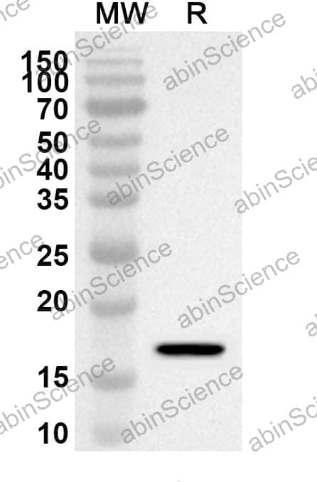 Anti-IFNA1/Interferon alpha-D Polyclonal Antibody