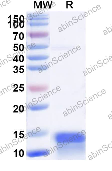 Anti-Human CALCA/Calcitonin Nanobody (SAA1243)