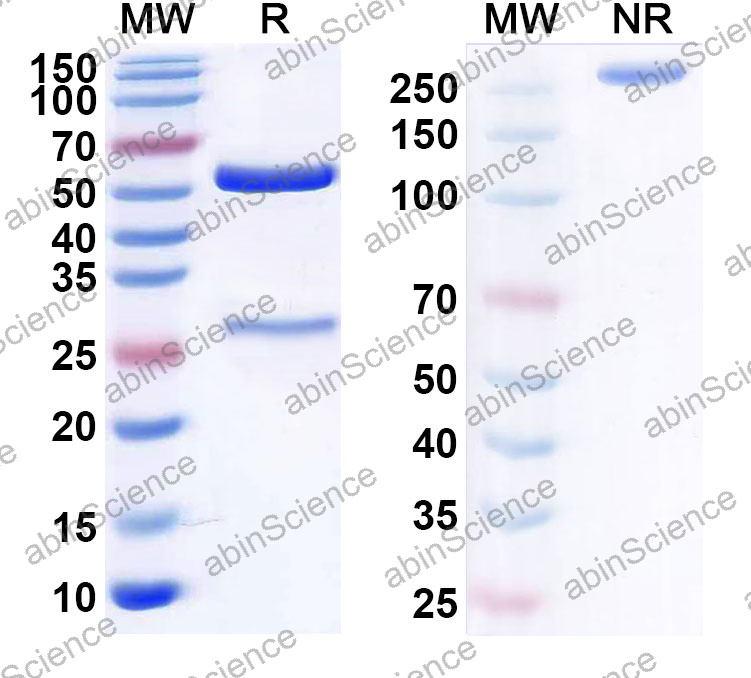 Anti-Human PCT/Procalcitonin Monoclonal Antibody (1A532)