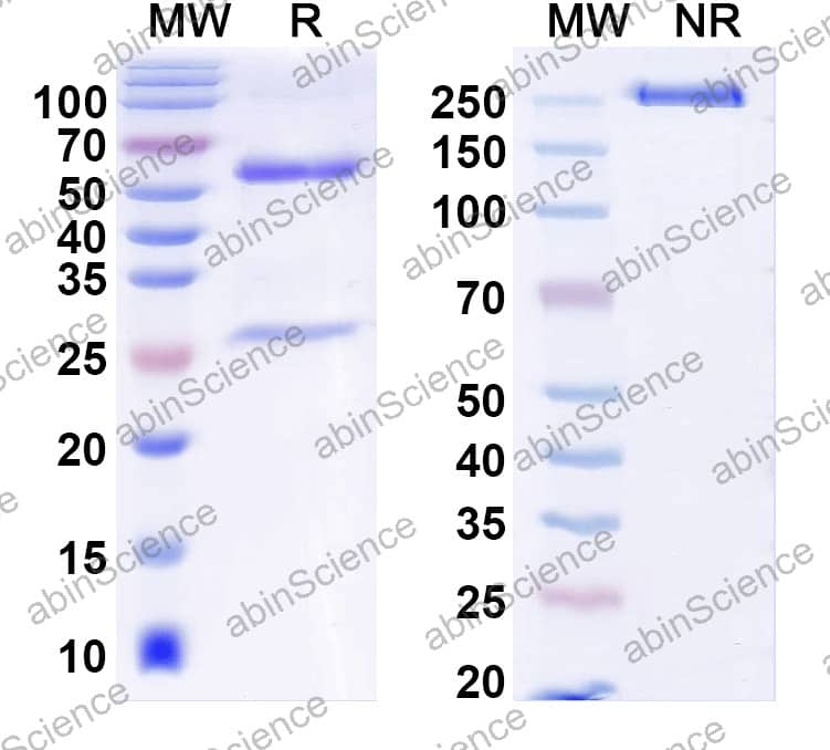 Anti-Human Alpha-1-antitrypsin/SERPINA1 Antibody (SAA2548)