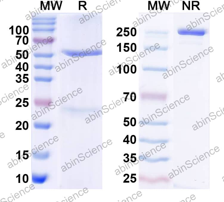 Anti-Human Angiotensin-2 Antibody (SAA2578)