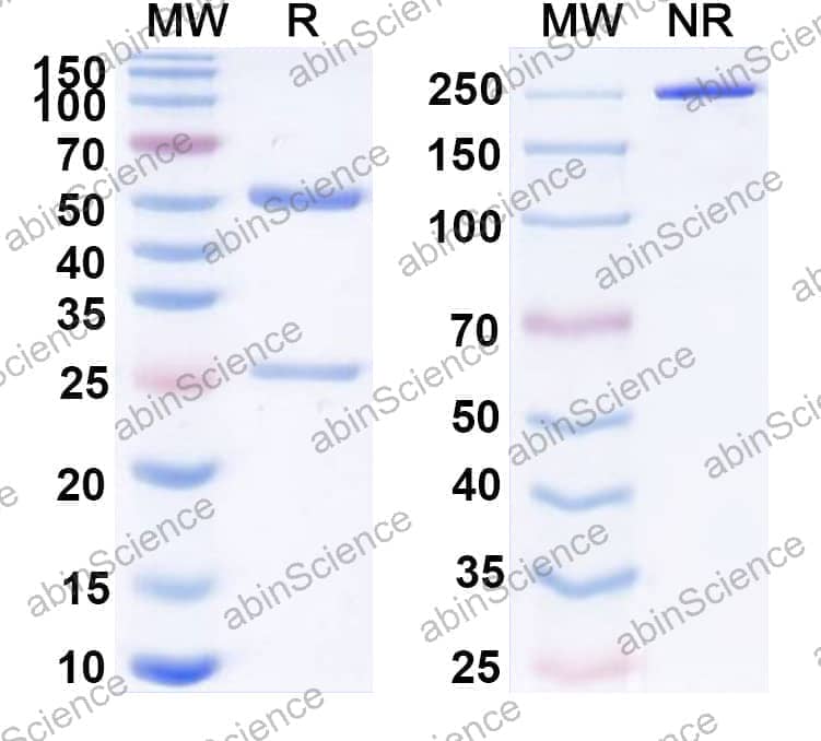 Anti-Human LTA/TNF-beta Antibody (SAA0416)