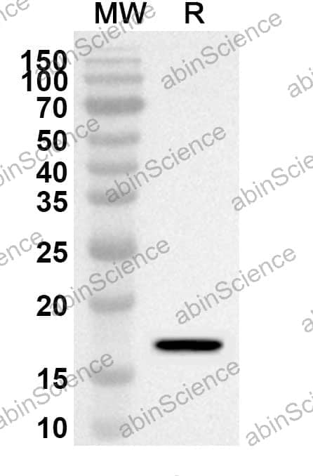 Anti-IFNG/IFN-gamma Polyclonal Antibody