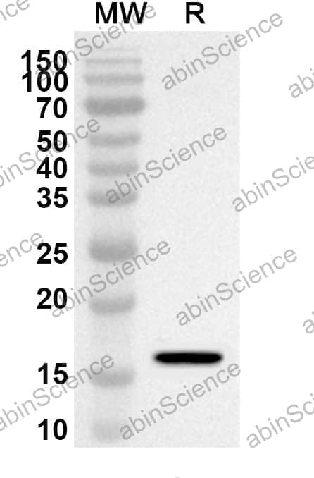 Anti-Human IFNG/IFN-gamma Polyclonal Antibody