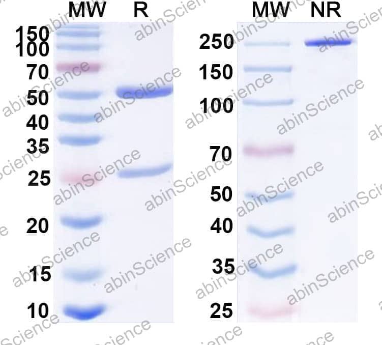 Anti-Human IFNG/IFN-gamma Antibody (SAA0414)