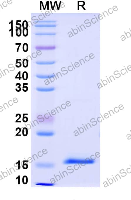 Anti-Human DKK1 Recombinant Nanobody (SAA1268)