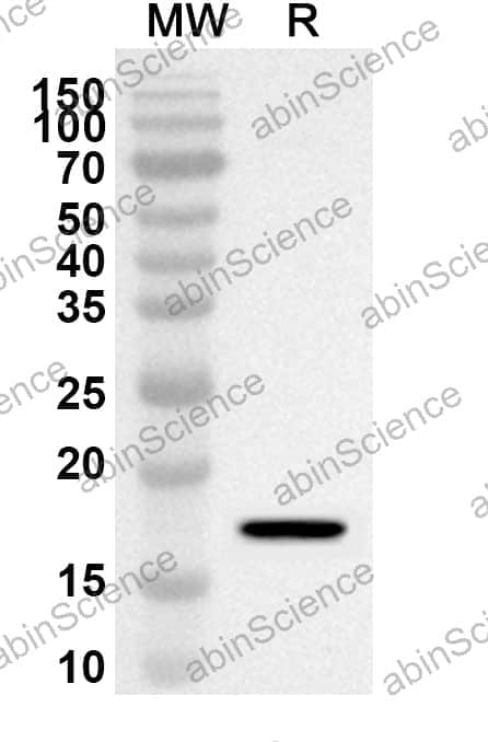 Anti-IL1B/IL1F2 Polyclonal Antibody