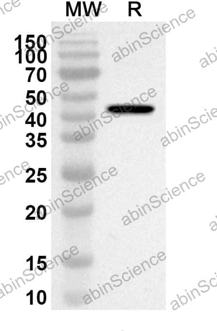 Anti-Human CD25/IL2RA Polyclonal Antibody