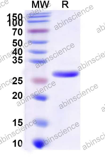 Recombinant Human HLA-DQB1 Protein, N-His
