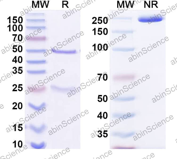 Anti-Human Transthyretin amyloidosis Antibody (9D5)