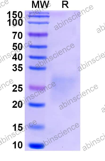 Recombinant Human VSIG4/CRIg Protein, C-His