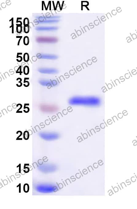 Recombinant Human VSIG4/CRIg Protein, N-His