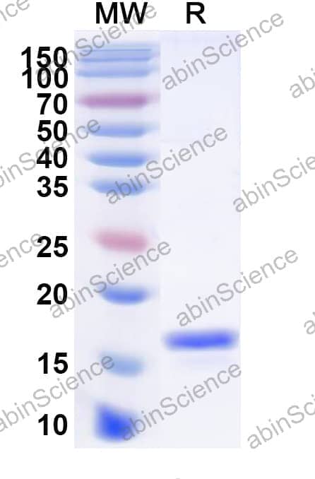 Anti-Human VSIG4/CRIg Nanobody (SAA1085)