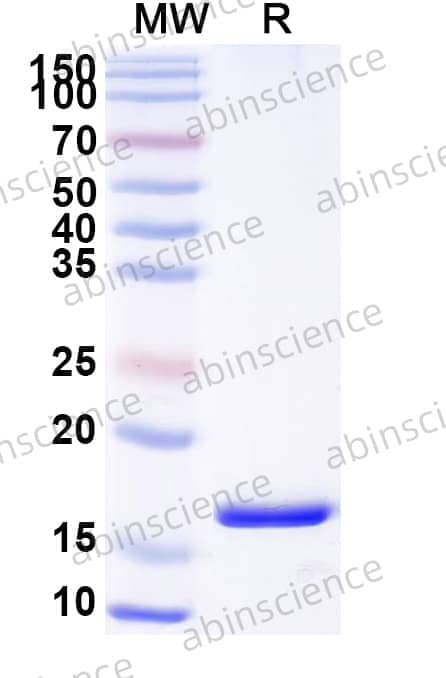 Anti-Human VSIG4/CRIg Nanobody (NbV4m119)