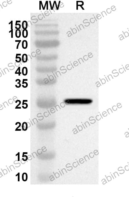 Anti-Human GSDMB Polyclonal Antibody