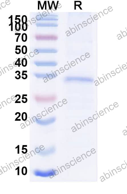 Recombinant Human FGF14 Protein, N-His