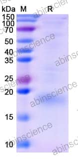 Recombinant Human TIGIT Protein, C-His